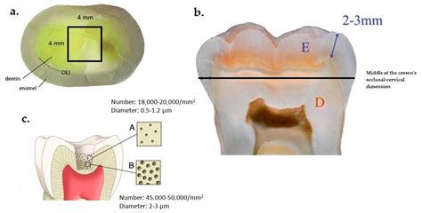 Efficiency of Various Tubular Occlusion Agents in Human Dentin after In-Office Tooth Bleaching