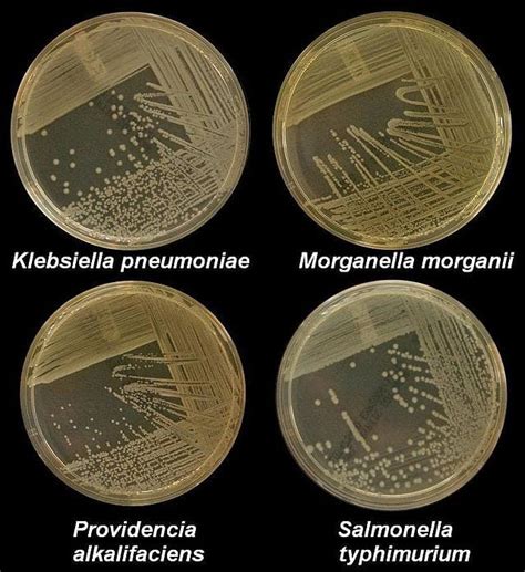 Nutrient Agar: Composition, Preparation and Uses