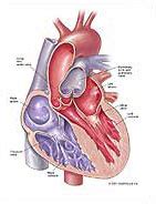 Heart Medical Illustration Exhibits - MediVisuals