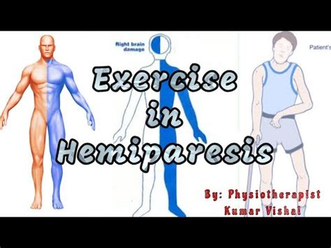 Exercise in Hemiparesis, फालिज में कसरतें, लकवे में कसरतें , exercise ...