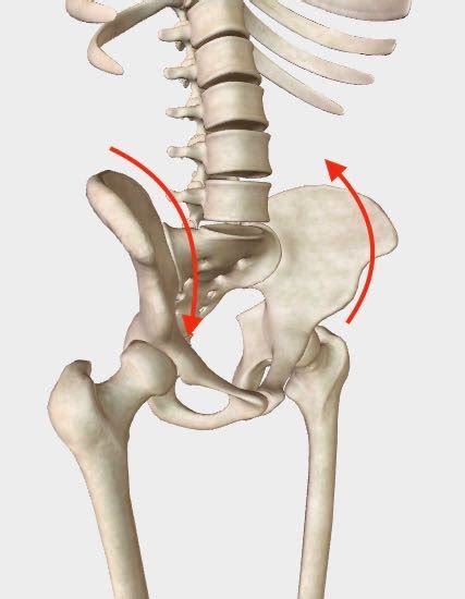 A Twisted Pelvis, also called Pelvic Torsion, Can Be Corrected