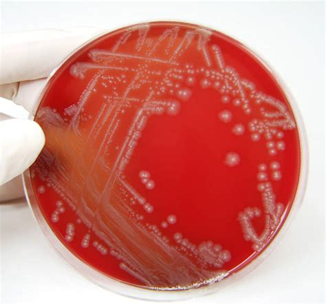 Best Fecal Coliform Bacteria Stock Photos, Pictures & Royalty-Free Images - iStock