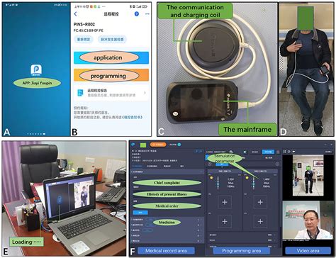 Frontiers | Remote Programming in Patients With Parkinson's Disease After Deep Brain Stimulation ...