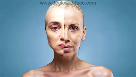 Degloved Face Surgery: Restoring Features and Confidence