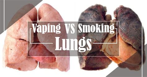 A Study on Vape Lungs vs Smoker Lungs