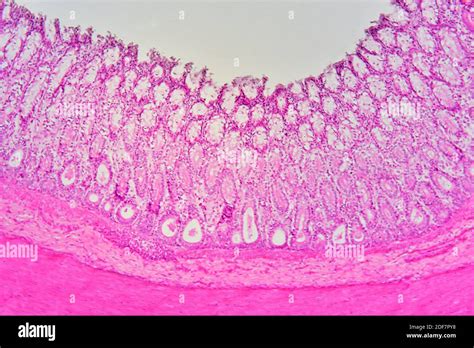 Appendix Cross Section