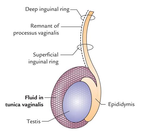 Lymphatic Drainage of the Pelvis – Earth's Lab