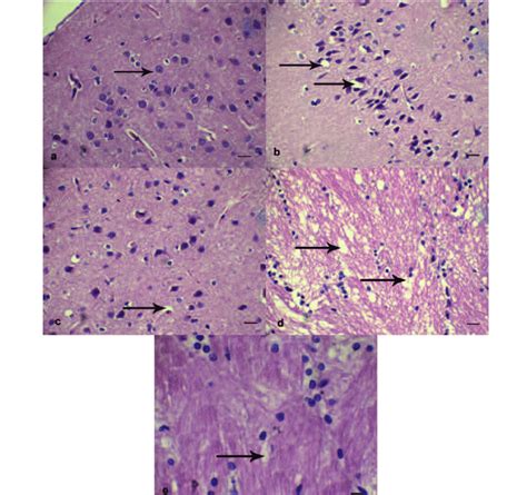 Neuronal morphology indicated by hematoxylin-eosin staining. A,... | Download Scientific Diagram