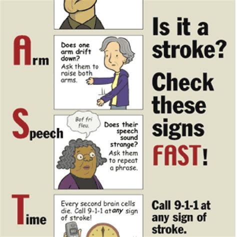 FAST Acronym, Based on the Cincinnati Prehospital Stroke Scale ...