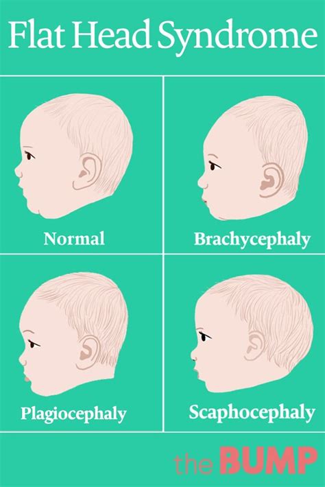 Flat head – Artofit