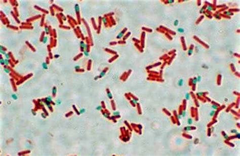 Endospore Staining - Principle, Procedure & Result Interpretation | Microbiology Practicals ...