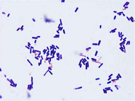 Clostridium Perfringens Gram Stain