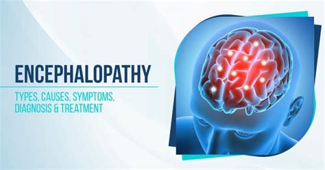 Encephalopathy: Types, Causes, Symptoms, Diagnosis & Treatment - GPSH | Ganadhipati Purshottam ...