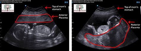 When Will I Feel My Baby Move? - Mother Nurture Ultrasound