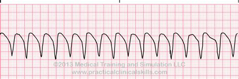 Matters of the Heart - Cardiac Arrest — PatMac,RN