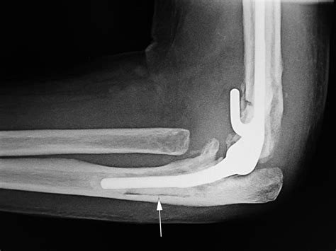 Medical Apparatus Imaging Guide: joint arthroplasty