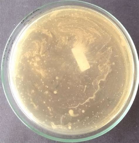 Nutrient Agar media showed the bacterial growth of sample B in third... | Download Scientific ...