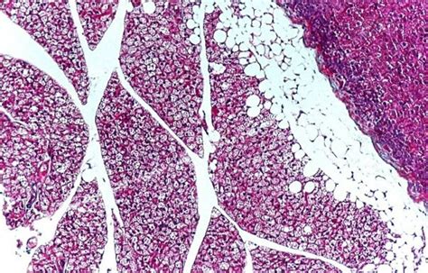 Plantão Médico: Histología del Tejido Conectivo Ordinario