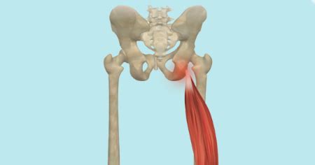 Sit Bone Pain Articles on Yoga Anatomy To Keep You Learning