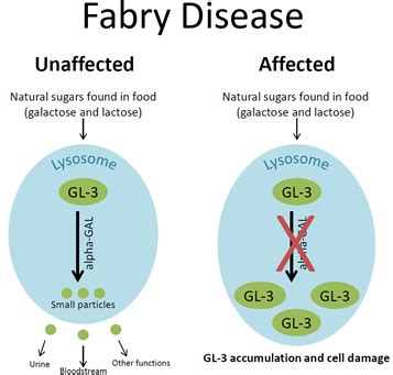 Fabry Disease – newbornscreening.info