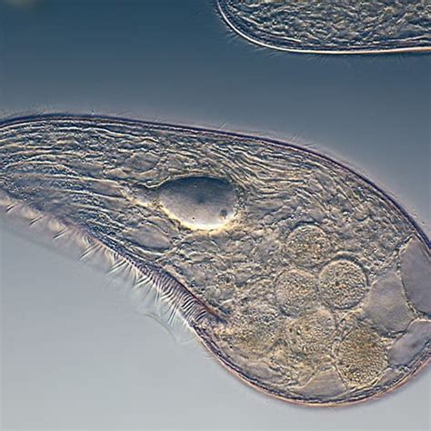 7 Types of Bacteria & Microorganisms In Pond Water - Pond Informer