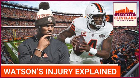 DESHAUN WATSON INJURY EXPLAINED | Dr. Jesse Morse on what happened ...