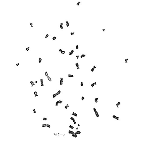 Karyotype of HAP1 Cells Lackin [IMAGE] | EurekAlert! Science News Releases