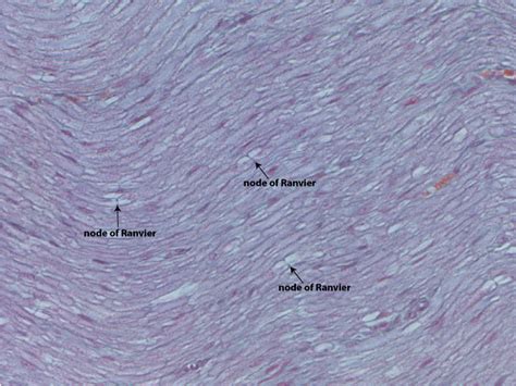 Structure of Neurons