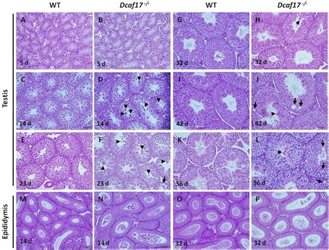 Histology of testes and cauda epididymides from WT and Dcaf17 −/− mice... | Download Scientific ...