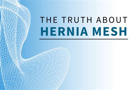 The Truth About Hernia Mesh | Department of Surgery | Washington ...