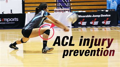 Exercise physiologist Don Moxley on ACL injury prevention - The Art of Coaching Volleyball