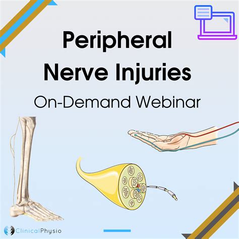 Peripheral Nerve Injuries On-Demand Webinar | Clinical Physio