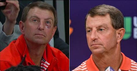 Clemson HC Dabo Swinney’s black eye sparks wild “Illuminati” theories from fans: "Illuminati ...