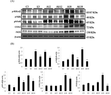 Moderate exercise training attenuates aging-induced cardiac inflammation, hypertrophy and ...