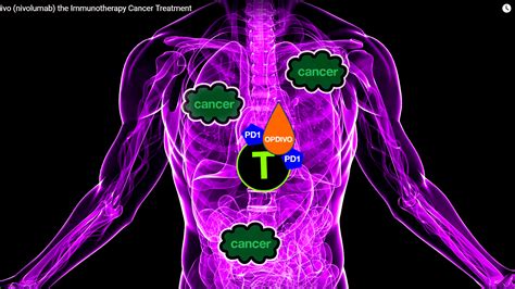 Immunotherapy Cancer Side Effects - Effect Choices