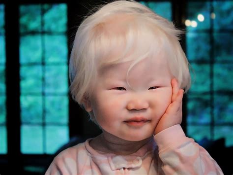 Unique Beauty Of Albino People | DeMilked