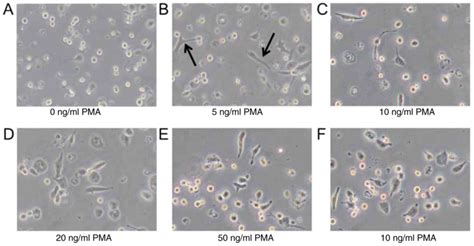 Effect of pulegone on the NLPR3 inflammasome during inflammatory ...