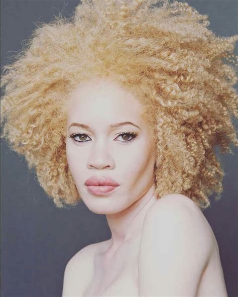 Black "Albino" Beauty | Albino model, Black women hairstyles, Natural ...