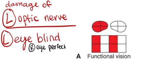 Cranial Nerve Screening Flashcards | Quizlet