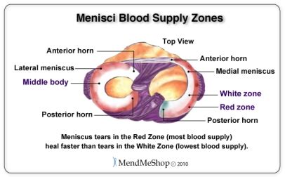 Lateral Meniscus - Physiopedia