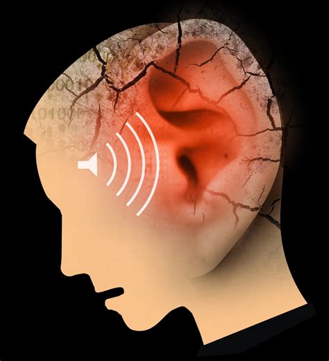 Tinnitus - All You Need To Know About The Ringing In Your Ears