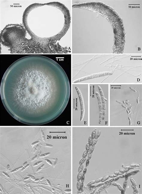 Thelonectria yunnanica (holotype). A. Median section of an ascoma; B.... | Download Scientific ...