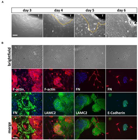 Frontiers | Keratinocytes Isolated From Individual Cleft Lip/Palate ...