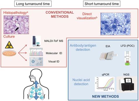 Laboratory Diagnosis of Histoplasmosis: An Update | IntechOpen