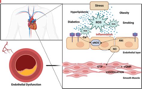 Connection of the oxidative stress mechanism generating ROS and... | Download Scientific Diagram