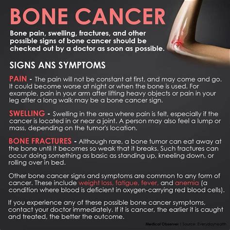 Early Signs And Symptoms Of Bone Cancer - CancerWalls