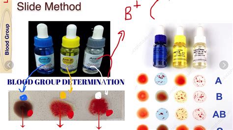 Blood Grouping Slide Method Part 2 5 - YouTube