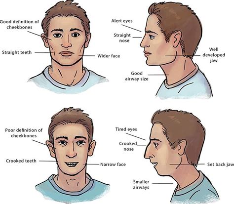 Related image | Chiseled jawline, Mouth breather, Jawline exercise