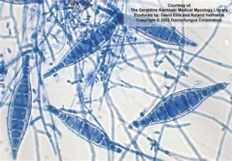 Microsporum canis Methylene Blue, Pale Yellow, Yellow Color ...