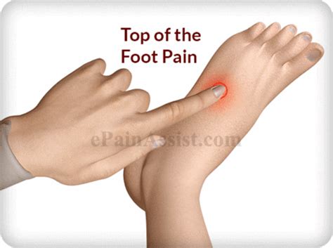 Top Of The Foot Pain GIFs - Find & Share on GIPHY